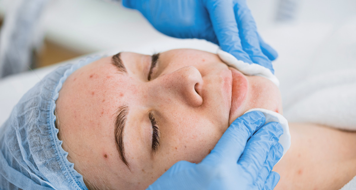 Spezielle Aknebehandlung Vorschau Artikelbild